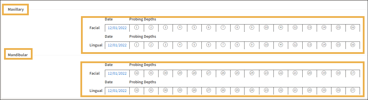 Create new Perio screen with yellow highlight boxes around Maxillary and Mandibular sections.